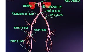 CT Lower Limb Angiography Anatomy CT scanPost processing avnishradiologypart1 [upl. by Laurance]