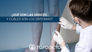 ¿Qué son las Várices y cuáles son los síntomas [upl. by Tootsie]