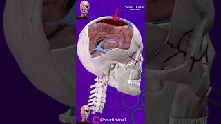 Subdural Hematoma  🧠🩸 [upl. by Noreh873]