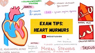 How to remember heart murmurs  Mnemonics Diagrams amp More  MedStudier [upl. by Olva]