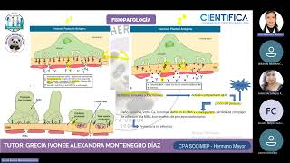 PHM NEFROPATÍA MEMBRANOSA [upl. by Lanoil]