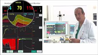 What are the hemodynamics effect of acute hypercapnia and acute hypoxia [upl. by Gibbeon]