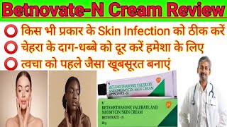 BetnovateN। BetnovateN Skin cream review 2023। How to uses betnovate n skin cream on face। [upl. by Zita]