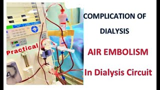 Complication During Dialysis  Air Embolism  Air In Dialysis circuit During Dialysis [upl. by Asirehc]