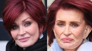 Worst Botched Celebrity Plastic Surgery Of 2024 You Cant Unsee [upl. by Abbottson]