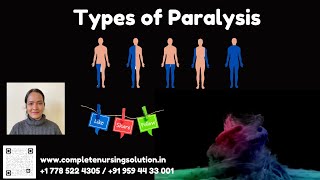 Types of Paralysis amp Its Nursing care nclex nclexpracticequestions paralysis paralysistreatment [upl. by Aniral]