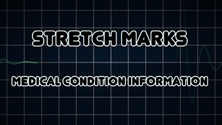 Stretch marks Medical Condition [upl. by Nyleek]