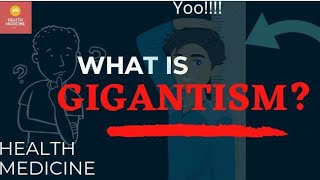 GIGANTISM  CAUSES  TREATMENT  SYMPTOMS  must watch video [upl. by Jacobba939]