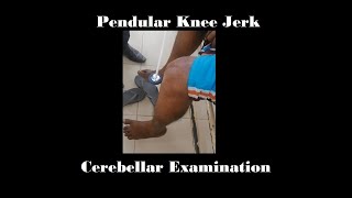 Pendular knee jerk  Cerebellar examination [upl. by Feinberg]