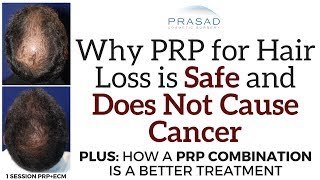 Why PRP for Hair Loss is Safe and Will Not Cause Cancer but a PRP Combination is a Better Treatment [upl. by Marucci690]