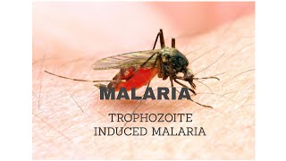 11MALARIA Trophozoite induced malaria [upl. by Yeruoc]