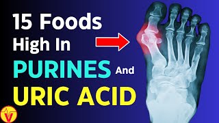 15 Foods HIGH in Purines and Uric Acid  Uric Acid Foods to Avoid  VisitJoy [upl. by Nay]