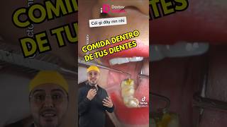 Lávate tus dientes siempre higienedental higienebucal limpiezadental caries dentista shorts [upl. by Silberman]