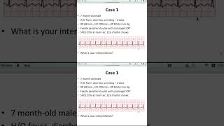 Ecg analysis case based approach [upl. by Anim]