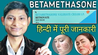 betamethasone valerate cream ip  betamethasone dipropionate cream  betnovate cream ke fayde [upl. by Dolorita]