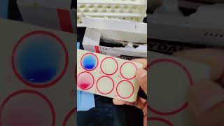 Widal testlab science chemistry motivation labtechnician scincefact sciencelab [upl. by Ttihw]