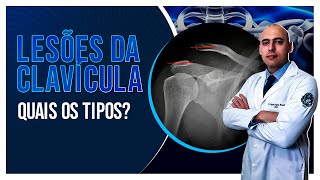 CLAVÍCULA QUEBRADA FISIOTERAPIA NO TRATAMENTO CIRÚRGICO DA FRATURA  Clínica Dr Robson Sitta [upl. by Nitsej]