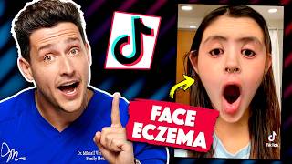 Shocking Medical Conditions On TikTok [upl. by Eimmas]