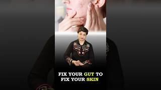 The Link Between Digestive Health amp Clear Skin Connection Between Acne Gut Health amp Skin Problems [upl. by Atilek424]