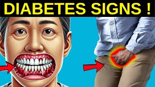 Are You at Risk 14 Weird Signs of Diabetes You Shouldn’t Ignore [upl. by Anirda]