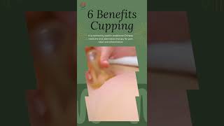 6 Surprising Benefits of Cupping in 30 Seconds [upl. by Womack]