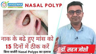 Nasal Polyps  Treat Nasal Polyps Without Surgery [upl. by Htehpaj]