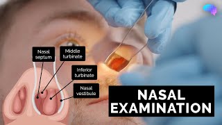 Nasal Examination  Nose Examination  OSCE Guide  UKMLA  CPSA [upl. by Ilanos]