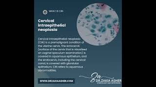 Understanding Cervical Intraepithelial Neoplasia CIN [upl. by Ettenajna]