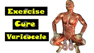 exercise for work cure varicocele [upl. by Iraam]