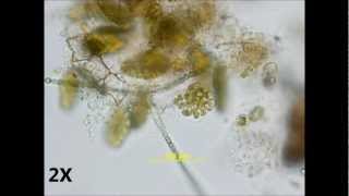 Pediastrum duplex  autocolony formation [upl. by Sul]