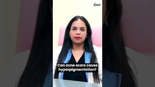 Acne Scars amp Hyperpigmentation  VCare Hair amp Skin Clinics  Skincare Tips [upl. by Ttehc]