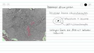 Fibrocartilage Fibrous cartilage Connective Tissue [upl. by Aleac806]