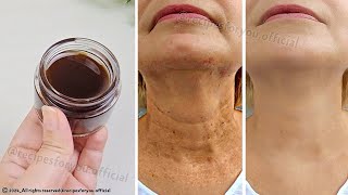 Anti aging magic oil ☘️ This oil will erase all the wrinkles on your face stronger than Botox [upl. by Ahsennek]