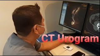 Work Of Art CT Scan Urogram Procedure [upl. by Ilil]