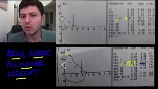 Spirometrie 8  recul elastic pulmonar crescut [upl. by Harrison312]