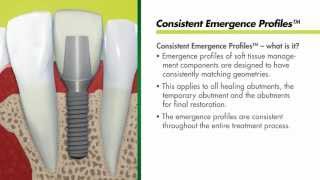 Straumann Bone Level Implants  Consistent Emergence Profiles [upl. by Niggem665]