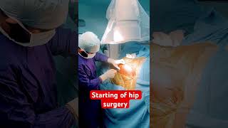 Live surgery for hip [upl. by Dragde544]