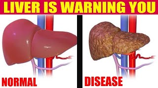 HOW CAN LIVER DISEASES AND CAUSES SYMPTOMS TREATMENT  Nature Cure Fit [upl. by Alletsyrc]