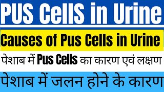 Pus Cells in Urine I Causes of Pus Cells in Urine I Pus Cells I Leukocytes in Urine I WBC in Urine I [upl. by Posehn]