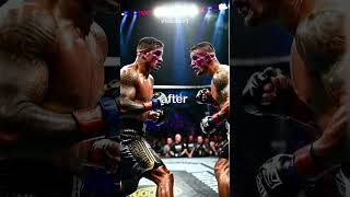 10 Times Anthony Pettis Surprised Everyone [upl. by Cilo172]