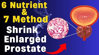 TOP 6 Nutrient and 7 Method to Shrink Your Enlarged Prostate  Christiansen Felix [upl. by Kablesh]