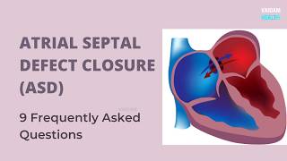 Atrial Septal Defect Closure9 Frequently Asked Questions [upl. by Britta]