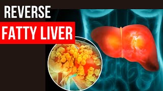 Herbs and Spices to Fix Fatty Liver Naturally [upl. by Lumbard769]