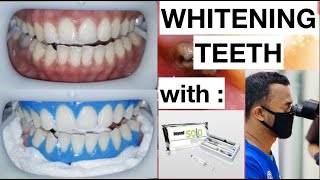 Colgate Max White ultimate LED teeth whitening kit step by step guide instructions [upl. by Enifesoj]