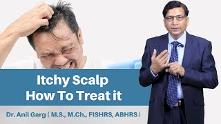 Itchy Scalp  How To Treat Itchy Scalp  Itchy Scalp And Hair Loss  Dr Anil Garg  Indore [upl. by Ettenom]