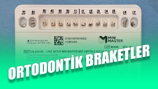 Ortodontik Braket Nedir Braket Çeşitleri Nelerdir Ortodonti Braketlerinin Özellikleri Nelerdir [upl. by Asyal589]