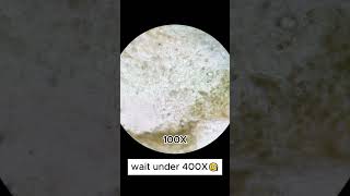 Shine muscat grapes magnified 400 times is surprisingshorts fyp microscope shortsvideo usa [upl. by Ronnoc]