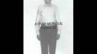 Atrax Morgue  She Was So BeautifulDead [upl. by Nnaeus]