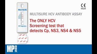 MULTISURE® HCV Antibody Assay [upl. by Marie745]