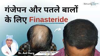 गंजेपन और पतले बालों के लिए Finasteride  FINASTERIDE क्या होता है  Right Dose Of Finasteride [upl. by Shargel]